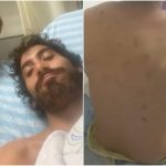 Brasileiro ferido em Israel foi atingido por estilhaços de granada
